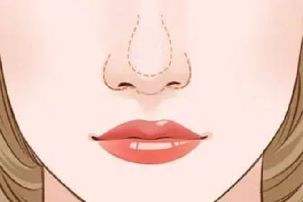 武漢鼻翼縮小好的醫(yī)院 武漢鼻翼縮小手術(shù)多少錢 武漢鼻翼縮小好的醫(yī)院 武漢鼻翼縮小手術(shù)多少錢