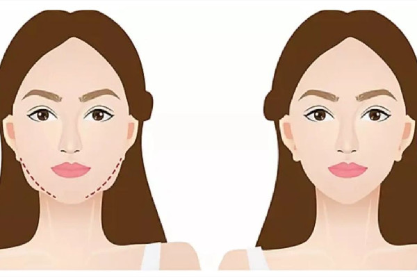 武漢削骨醫(yī)院哪家好 武漢削骨手術(shù)多少錢(qián) 武漢削骨醫(yī)院哪家好 武漢削骨手術(shù)多少錢(qián)