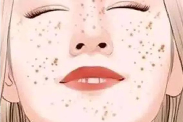 武漢激光祛斑哪個(gè)醫(yī)院比較好 武漢激光祛斑多少錢(qián)一次 武漢激光祛斑哪個(gè)醫(yī)院比較好 武漢激光祛斑多少錢(qián)一次