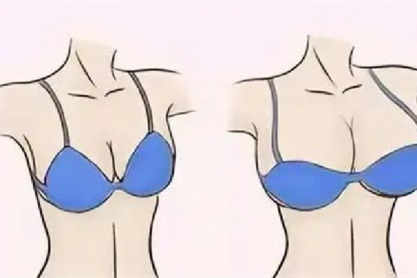 武漢假體隆胸哪家醫(yī)院好 武漢假體隆胸多少錢 武漢假體隆胸哪家醫(yī)院好 武漢假體隆胸多少錢