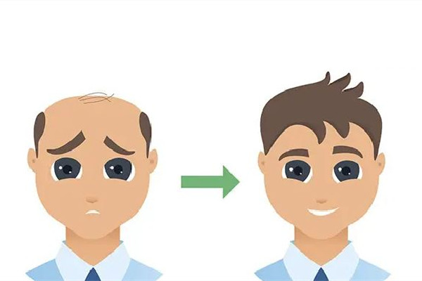 武漢植發(fā)醫(yī)院哪家好 武漢植發(fā)要多少錢 武漢植發(fā)醫(yī)院哪家好 武漢植發(fā)要多少錢