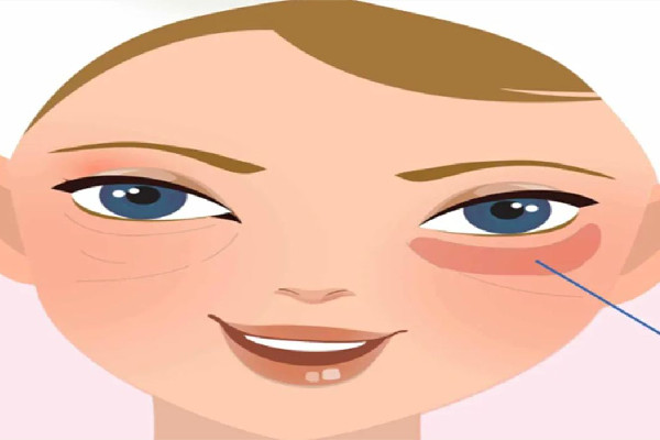 武漢打去眼袋針的醫(yī)院 武漢打去眼袋針多少錢(qián) 武漢打去眼袋針的醫(yī)院 武漢打去眼袋針多少錢(qián)