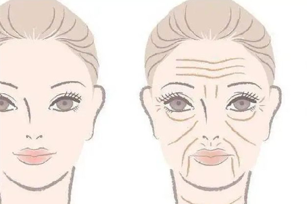 武漢除皺針可以報(bào)醫(yī)保嗎 武漢哪里打除皺針好 武漢除皺針可以報(bào)醫(yī)保嗎 武漢哪里打除皺針好