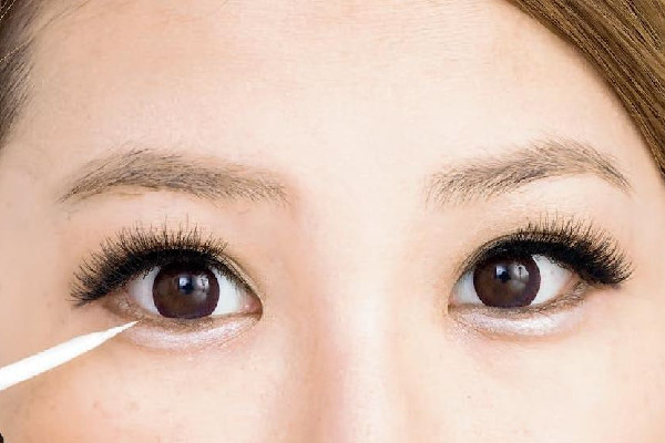 武漢填充臥蠶哪家好 武漢臥蠶手術哪個醫(yī)院做的好 武漢填充臥蠶哪家好 武漢臥蠶手術哪個醫(yī)院做的好