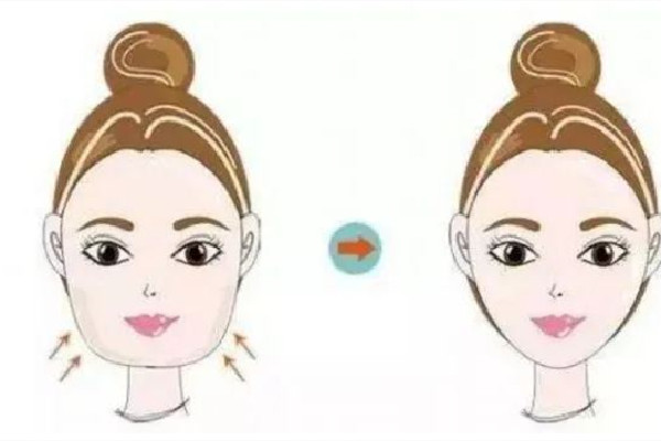 武漢面部吸脂價(jià)格大概多少錢(qián) 武漢面部吸脂醫(yī)院排行 武漢面部吸脂價(jià)格大概多少錢(qián) 武漢面部吸脂醫(yī)院排行