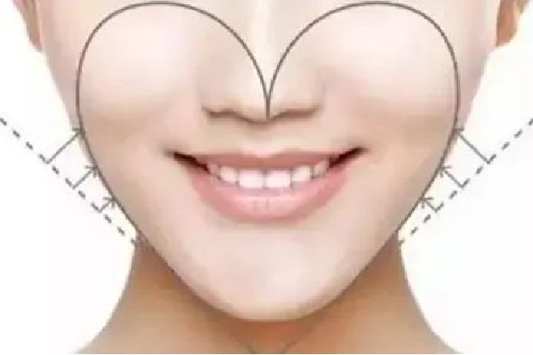 武漢面部吸脂價(jià)格大概多少錢(qián) 武漢面部吸脂醫(yī)院排行 武漢面部吸脂價(jià)格大概多少錢(qián) 武漢面部吸脂醫(yī)院排行