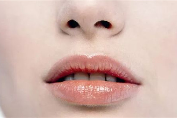 武漢脫唇毛哪個(gè)醫(yī)院最好 武漢協(xié)和醫(yī)院脫唇毛多少錢 武漢脫唇毛哪個(gè)醫(yī)院最好 武漢協(xié)和醫(yī)院脫唇毛多少錢