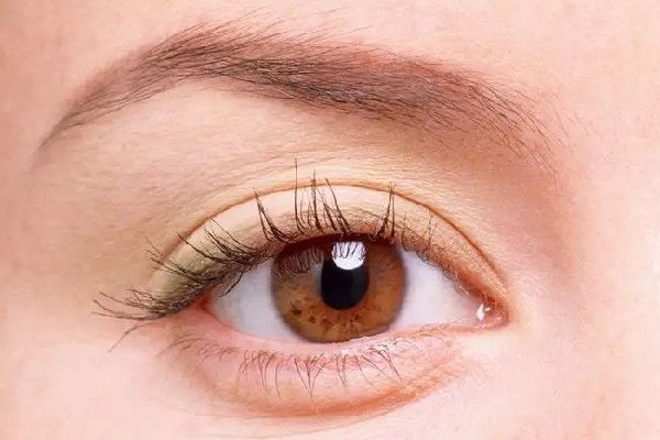 武漢眼角上揚手術多少錢 武漢眼角上揚手術去哪家醫(yī)院 武漢眼角上揚手術多少錢 武漢眼角上揚手術去哪家醫(yī)院