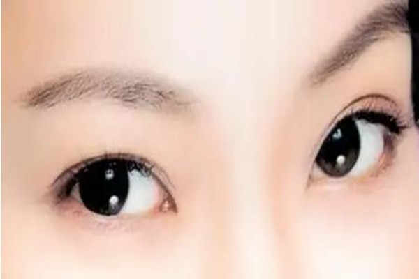 武漢韓式雙眼皮整形醫(yī)院哪家好 武漢韓式雙眼皮價(jià)格 武漢韓式雙眼皮整形醫(yī)院哪家好 武漢韓式雙眼皮價(jià)格