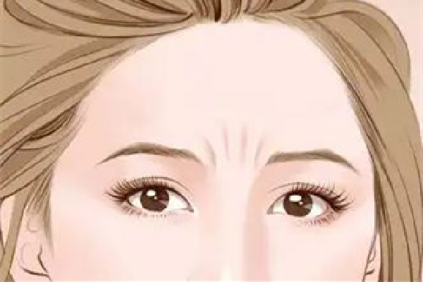 武漢去川字紋哪家美容醫(yī)院好 武漢去川字紋大概多少錢 武漢去川字紋哪家美容醫(yī)院好 武漢去川字紋大概多少錢