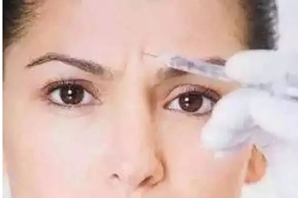 武漢眉間紋去除最好的醫(yī)院 武漢眉間紋去額頭皺紋的方法 武漢眉間紋去除最好的醫(yī)院 武漢眉間紋去額頭皺紋的方法