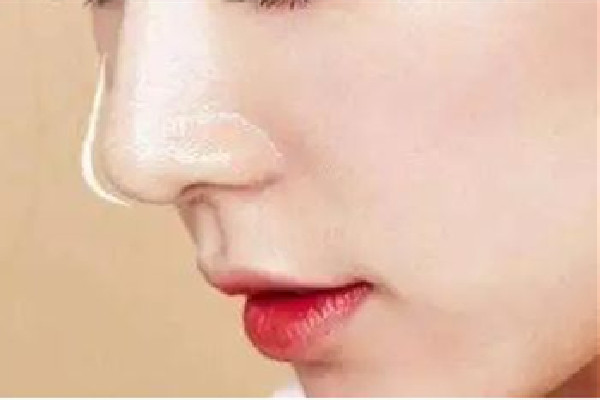 武漢假體隆鼻哪里好 武漢假體隆鼻費用 武漢假體隆鼻哪里好 武漢假體隆鼻費用