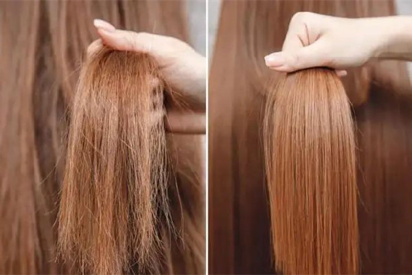 干性頭發(fā)會(huì)變成油性頭發(fā)嗎 干性頭發(fā)會(huì)導(dǎo)致頭皮屑嗎 干性頭發(fā)會(huì)變成油性頭發(fā)嗎 干性頭發(fā)會(huì)導(dǎo)致頭皮屑嗎