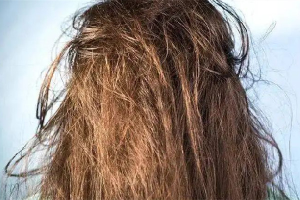 干性頭發(fā)怎么護理 干性頭發(fā)用有硅油的好一點還是用無硅油好