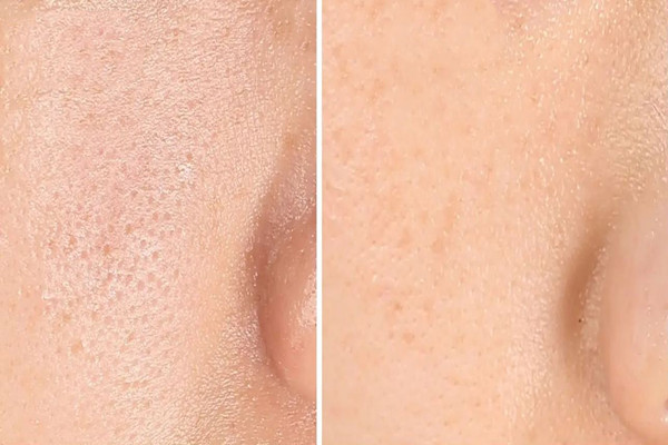 江漢路店一格皮膚美容管理中心皮膚檢測做的怎么樣 江漢路店一格皮膚美容管理中心毛孔清潔做的好嗎 江漢路店一格皮膚美容管理中心皮膚檢測做的怎么樣 江漢路店一格皮膚美容管理中心毛孔清潔做的好嗎