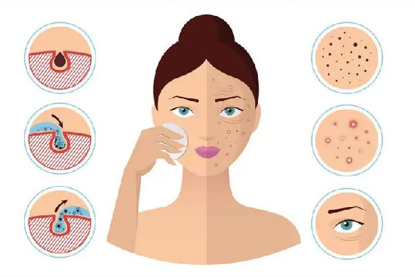 光谷W·SKIN皮膚管理中心毛孔清潔做的好嗎 光谷W·SKIN皮膚管理中心臉部護理做的怎么樣 光谷W·SKIN皮膚管理中心毛孔清潔做的好嗎 光谷W·SKIN皮膚管理中心臉部護理做的怎么樣