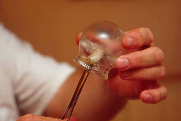 江漢路步行街溯美減肥美容養(yǎng)生拔罐項(xiàng)目怎么樣 拔罐對身體有什么樣的好處 江漢路步行街溯美減肥美容養(yǎng)生拔罐項(xiàng)目怎么樣 拔罐對身體有什么樣的好處