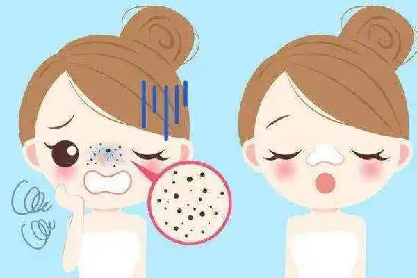 光谷MG問題皮膚管理中心去黑頭體驗(yàn)怎么樣 去黑頭去美容院有用嗎 光谷MG問題皮膚管理中心去黑頭體驗(yàn)怎么樣 去黑頭去美容院有用嗎