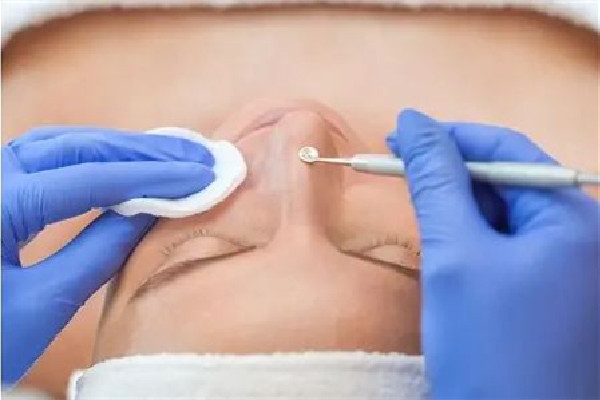 光谷天地花遇·容顏管理店針清效果怎么樣 針清祛痘有用嗎 光谷天地花遇·容顏管理店針清效果怎么樣 針清祛痘有用嗎