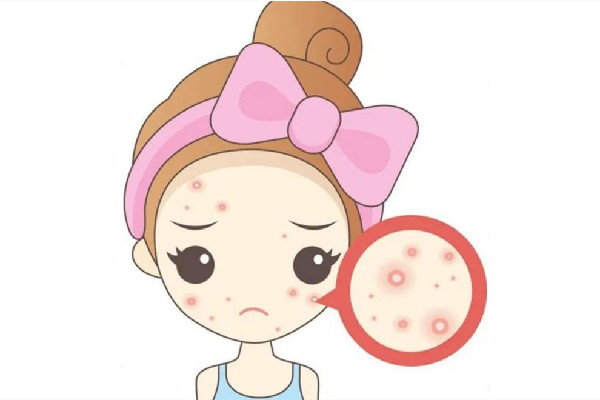 光谷天地傾顏皮膚管理中心痘痘肌護(hù)理效果怎么樣 痘痘肌多久可以改善過(guò)來(lái) 光谷天地傾顏皮膚管理中心痘痘肌護(hù)理效果怎么樣 痘痘肌多久可以改善過(guò)來(lái)