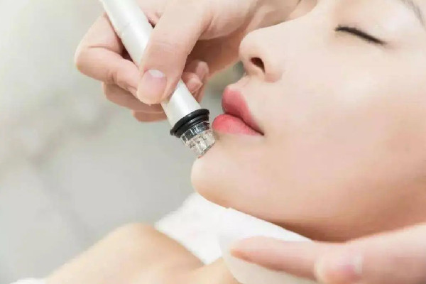 水果湖清顏堂專業(yè)祛痘小氣泡體驗(yàn)感怎么樣 小氣泡可以縮小毛孔嗎 水果湖清顏堂專業(yè)祛痘小氣泡體驗(yàn)感怎么樣 小氣泡可以縮小毛孔嗎