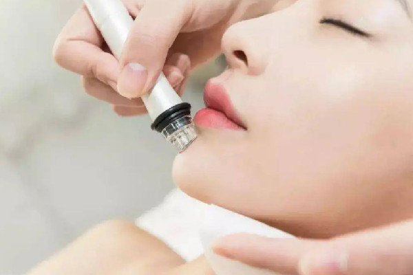 積玉橋俏佳人美容形象會所小氣泡做完之后效果好不好 小氣泡可以維持多久 積玉橋俏佳人美容形象會所小氣泡做完之后效果好不好 小氣泡可以維持多久