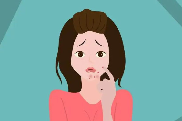 中南路漾膚皮膚管理店痘肌護理項目怎么樣 痘痘肌護理注意事項 中南路漾膚皮膚管理店痘肌護理項目怎么樣 痘痘肌護理注意事項