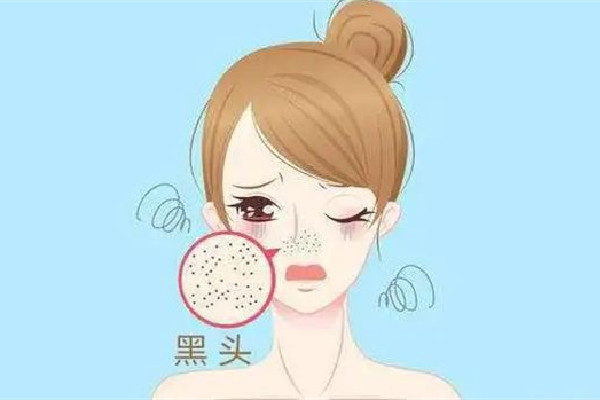 中南路MY科技纖體美膚連鎖店改善黑頭項目做完后怎么樣 改善黑頭粉刺的方法 中南路MY科技纖體美膚連鎖店改善黑頭項目做完后怎么樣 改善黑頭粉刺的方法