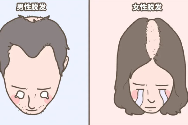 掉發(fā)有白色顆粒是什么 掉發(fā)有白色毛囊還會(huì)在長嗎