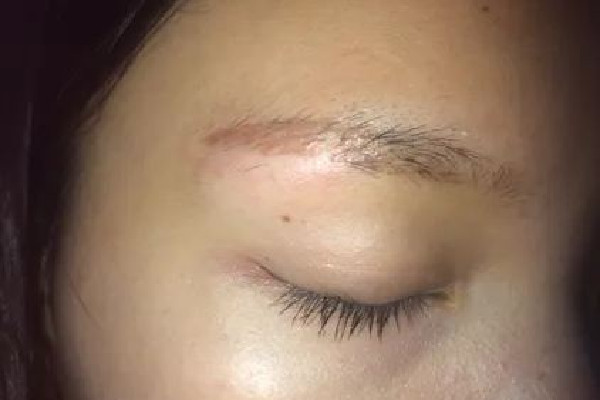 中南路美涵·半永久美睫美膚館洗眉后效果怎么樣 洗眉是不是很疼 中南路美涵·半永久美睫美膚館洗眉后效果怎么樣 洗眉是不是很疼