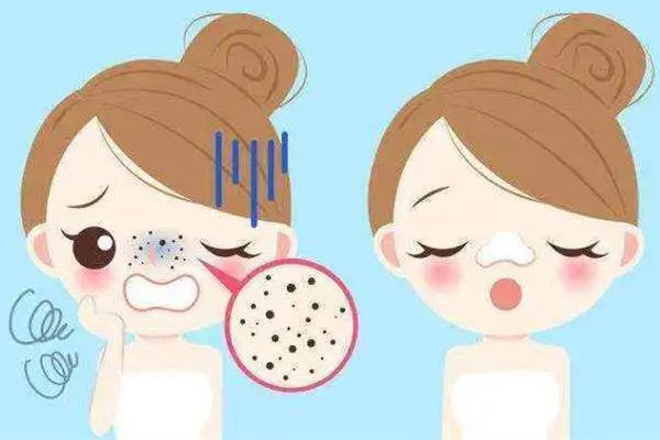 中南路夢都?巴厘女子SPA養(yǎng)生會所去黑頭后效果怎么樣 去黑頭可以去皮膚科嗎