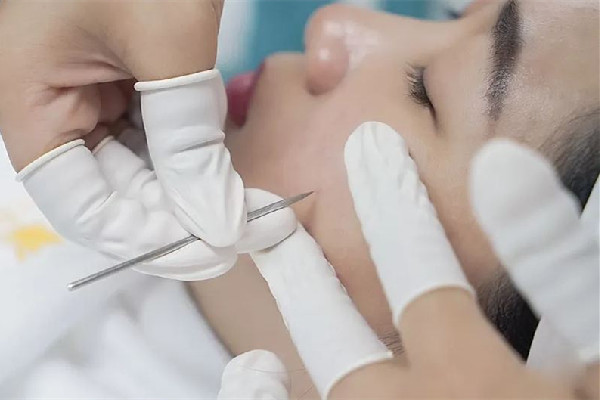 中南路熙格輕奢皮膚管理店針清項目怎么樣 針清有依賴性嗎 中南路熙格輕奢皮膚管理店針清項目怎么樣 針清有依賴性嗎