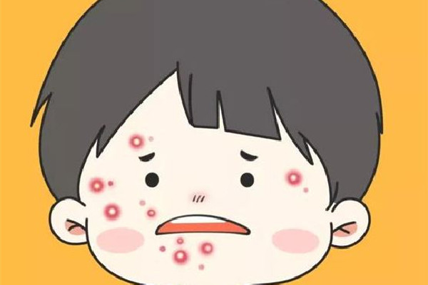 中南路佐康專業(yè)祛痘店全臉祛痘怎么樣 痘痘可以擠掉嗎 中南路佐康專業(yè)祛痘店全臉祛痘怎么樣 痘痘可以擠掉嗎