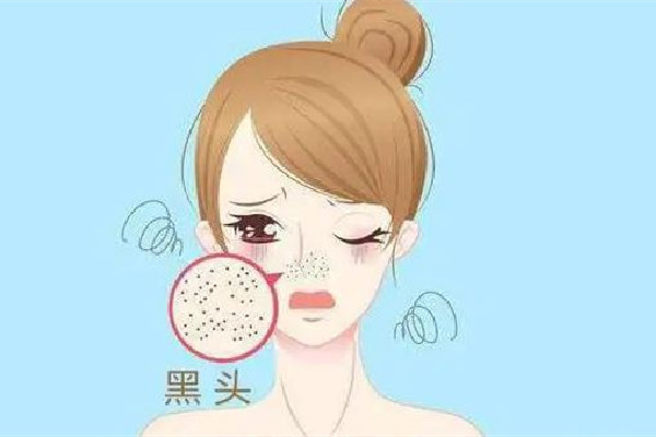 中南路佐康專業(yè)祛痘店去黑頭后感覺好嗎 去一次黑頭能管多久 中南路佐康專業(yè)祛痘店去黑頭后感覺好嗎 去一次黑頭能管多久