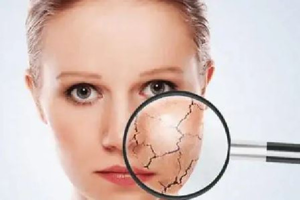 中南路丹鳳眼國際眼部美容連鎖機構可以緩解面部干燥嗎 面部干燥怎么補水效果好 中南路丹鳳眼國際眼部美容連鎖機構可以緩解面部干燥嗎 面部干燥怎么補水效果好