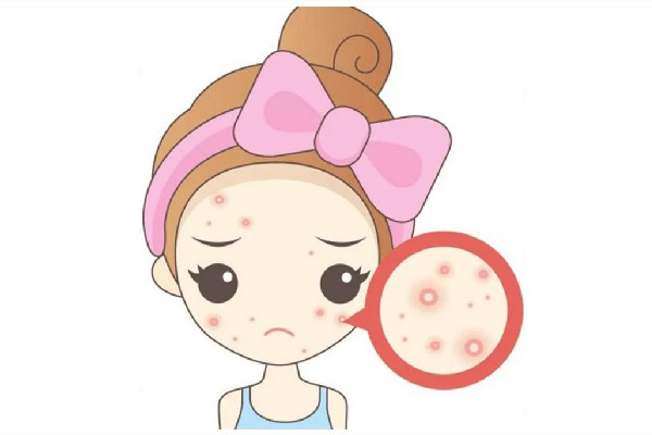 中南路Comely Lady美學(xué)中心店痘肌清潔怎么樣 痘肌多久用一次清潔面膜 中南路Comely Lady美學(xué)中心店痘肌清潔怎么樣 痘肌多久用一次清潔面膜