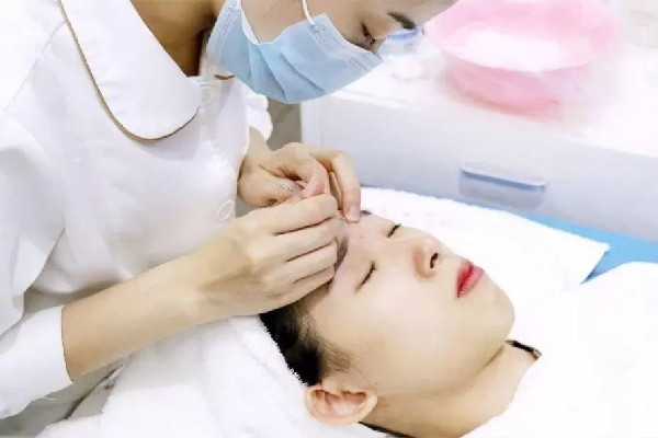 后湖SOR索爾祛痘?面部肌膚科學管理針清效果怎么樣 針清會讓毛孔變大嗎 后湖SOR索爾祛痘?面部肌膚科學管理針清效果怎么樣 針清會讓毛孔變大嗎