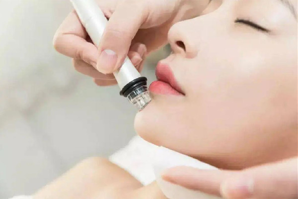 后湖武漢美加立芳醫(yī)療美容門診部小氣泡項(xiàng)目體驗(yàn)感怎么樣 小氣泡有必要一周做一次嗎 后湖武漢美加立芳醫(yī)療美容門診部小氣泡項(xiàng)目體驗(yàn)感怎么樣 小氣泡有必要一周做一次嗎