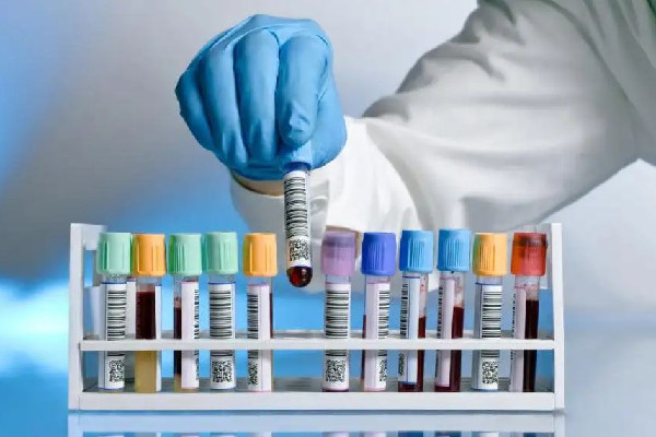 醫(yī)生飛針采血被贊“蚊子投胎” 采血都能檢查出來什么 醫(yī)生飛針采血被贊“蚊子投胎” 采血都能檢查出來什么