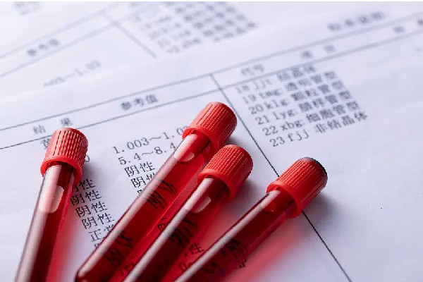 醫(yī)生飛針采血被贊“蚊子投胎” 采血都能檢查出來什么 醫(yī)生飛針采血被贊“蚊子投胎” 采血都能檢查出來什么