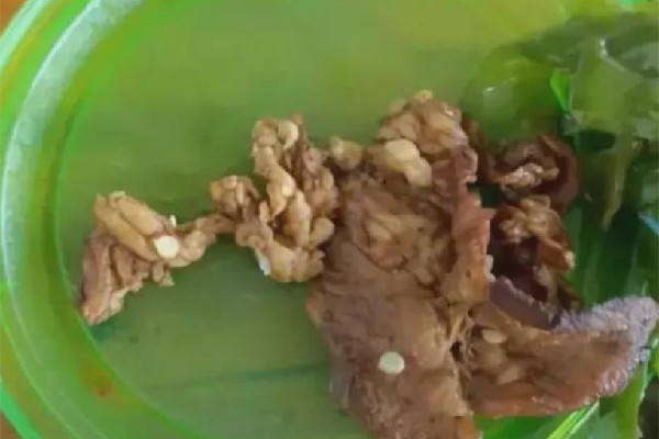 學(xué)生質(zhì)疑店家賣淋巴肉被威脅 淋巴肉吃了會(huì)怎樣 學(xué)生質(zhì)疑店家賣淋巴肉被威脅 淋巴肉吃了會(huì)怎樣