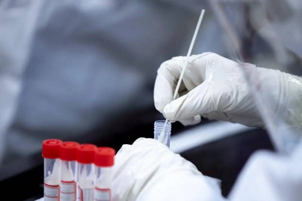 媒體:核酸亂象不止疫情永無寧日 核酸檢測(cè)上的棉簽有什么成分