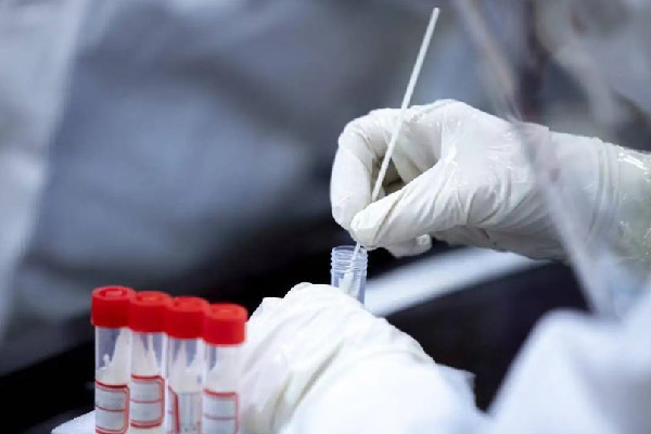 核酸機(jī)構(gòu)造假頻現(xiàn) 官方:嚴(yán)肅處置 專家:核酸檢測公司該不該上市 核酸機(jī)構(gòu)造假頻現(xiàn) 官方:嚴(yán)肅處置 專家:核酸檢測公司該不該上市