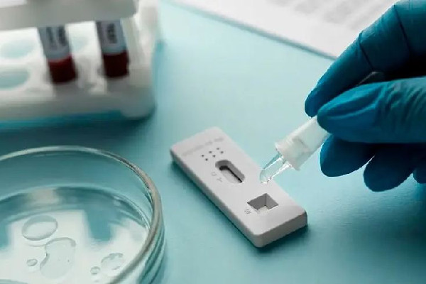 抗原買不到,誰在囤貨 抗原檢測結(jié)果怎么看 抗原買不到,誰在囤貨 抗原檢測結(jié)果怎么看