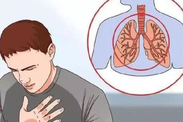 咳嗽什么樣子代表要好了 咳嗽快速止咳小妙招 咳嗽什么樣子代表要好了 咳嗽快速止咳小妙招