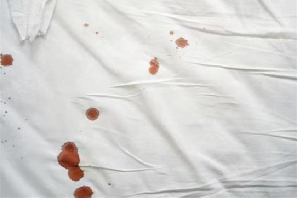 女子剪掉丈夫下體被拘10日罰款200 夫妻關系如何經(jīng)營