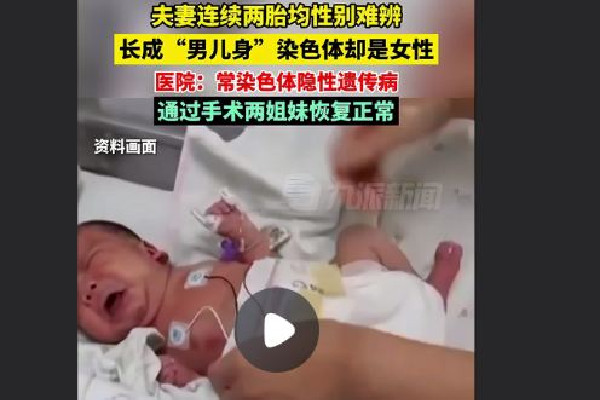 夫妻連生兩胎均患怪病性別難辨 懷孕的時(shí)候能檢查出孩子那些問題 夫妻連生兩胎均患怪病性別難辨 懷孕的時(shí)候能檢查出孩子那些問題