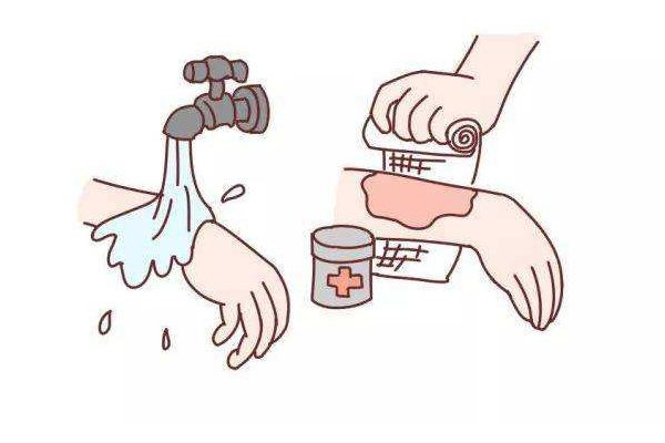 男子照顧大面積燒傷女友6年 大面積燒傷要多長(zhǎng)時(shí)間才會(huì)恢復(fù) 男子照顧大面積燒傷女友6年 大面積燒傷要多長(zhǎng)時(shí)間才會(huì)恢復(fù)