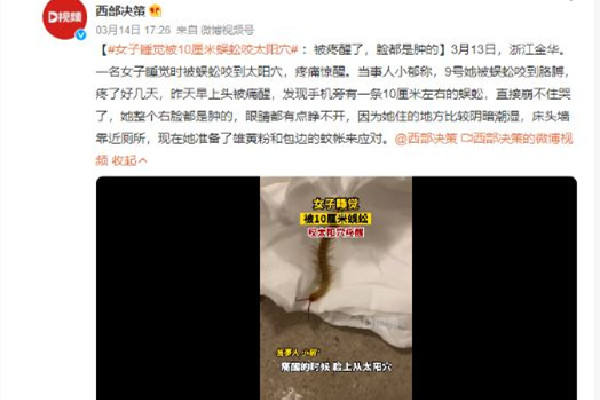 女子睡覺時(shí)被10厘米蜈蚣咬太陽穴 被蜈蚣咬了會(huì)有生命危險(xiǎn)嗎 女子睡覺時(shí)被10厘米蜈蚣咬太陽穴 被蜈蚣咬了會(huì)有生命危險(xiǎn)嗎